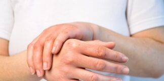 Realizarán diagnóstico de esclerodermia en el hospital Señor del Milagro