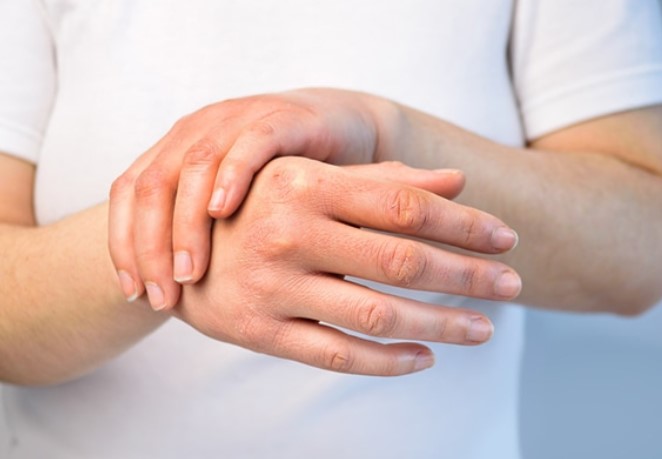 esclerodermia